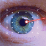Лазерная коррекция зрения – какой метод выбрать?